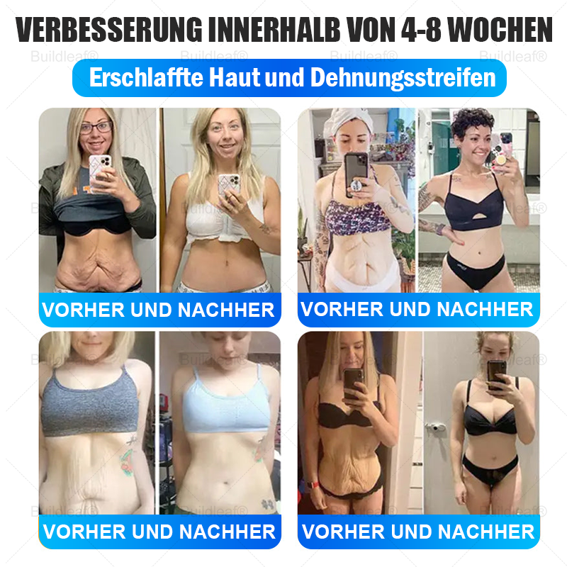 Buildleaf® – Nur noch 10 Packungen verfügbar! Sichere dir jetzt exklusiv 30 % Rabatt! Bringe deinen Körper in nur 1 bis 3 Wochen wieder zum Strahlen und halte ihn jung. ❗ Verpasse diese Chance nicht – dieses Angebot kommt erst nächstes Jahr wieder.