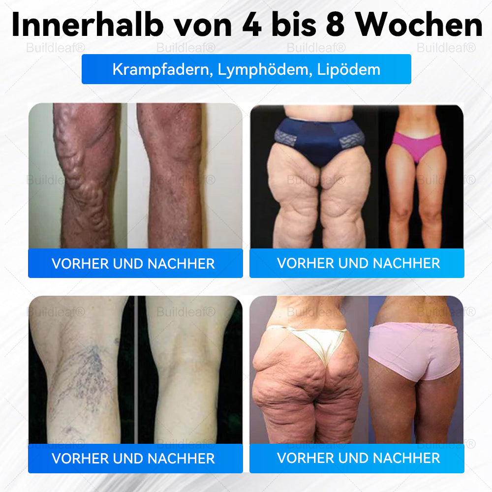 Buildleaf® – Nur noch 10 Packungen verfügbar! Sichere dir jetzt exklusiv 30 % Rabatt! Bringe deinen Körper in nur 1 bis 3 Wochen wieder zum Strahlen und halte ihn jung. ❗ Verpasse diese Chance nicht – dieses Angebot kommt erst nächstes Jahr wieder.