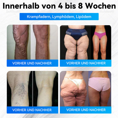 Buildleaf® – Letzte Chance! Schnapp dir diesen Glücksfund mit 50 % RABATT!  ✅ 180 Tage Geld-zurück-Garantie ✈️ Kostenloser Luftversand!